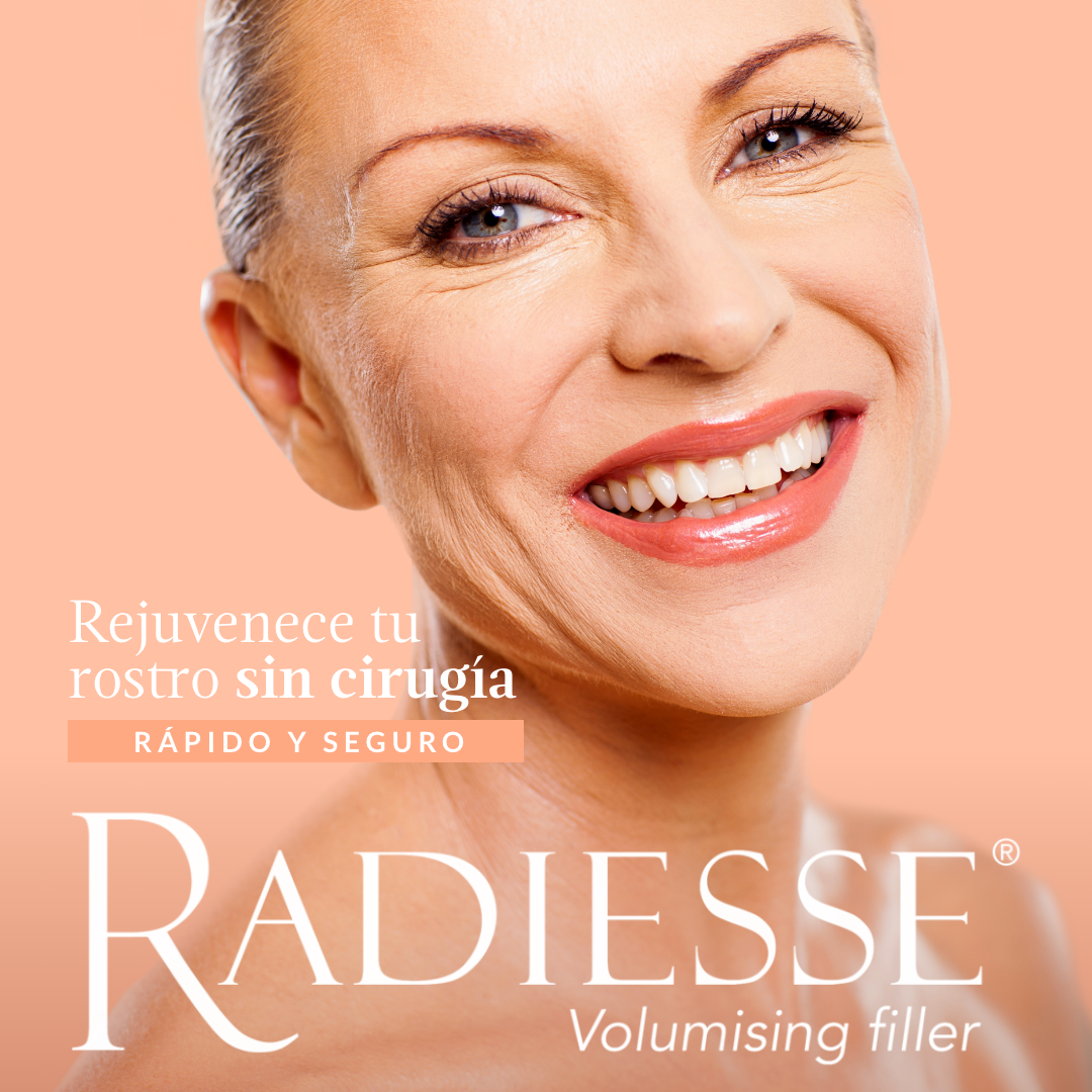 Radiesse Rejuvenecimiento facial
