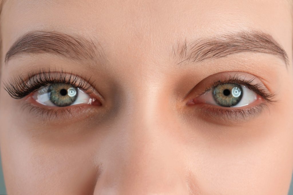 conoce tu tipo de ojeras